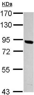 Western blot - Anti-PNPLA8 antibody (AB154233), expandable thumbnail