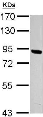 Western blot - Anti-PNPLA8 antibody (AB154233)