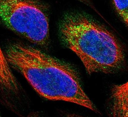 Immunocytochemistry/ Immunofluorescence - Anti-PNPLA8 antibody (AB223726)