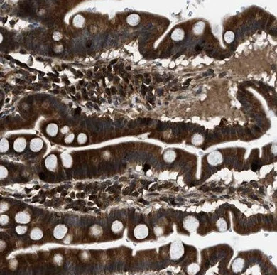 Immunohistochemistry (Formalin/PFA-fixed paraffin-embedded sections) - Anti-PNPLA8 antibody (AB223726)