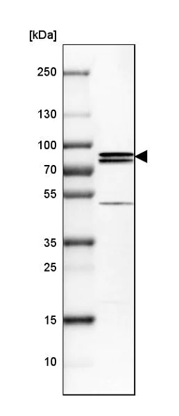 Western blot - Anti-PNPLA8 antibody (AB223726)