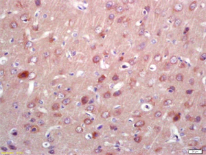 Immunohistochemistry (Formalin/PFA-fixed paraffin-embedded sections) - Anti-PNPO antibody (AB203745)
