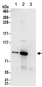 Immunoprecipitation - Anti-PNPT1 antibody (AB157109), expandable thumbnail