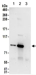 Immunoprecipitation - Anti-PNPT1 antibody (AB157109)
