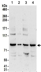 Western blot - Anti-PNPT1 antibody (AB157109), expandable thumbnail