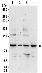 Western blot - Anti-PNPT1 antibody (AB157109)