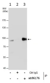 Immunoprecipitation - Anti-PNPT1 antibody (AB96176)