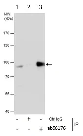 Immunoprecipitation - Anti-PNPT1 antibody (AB96176)