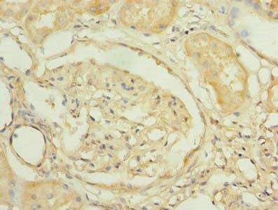 Immunohistochemistry (Formalin/PFA-fixed paraffin-embedded sections) - Anti-PNRC2 antibody (AB235599), expandable thumbnail