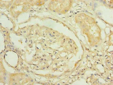 Immunohistochemistry (Formalin/PFA-fixed paraffin-embedded sections) - Anti-PNRC2 antibody (AB235599)