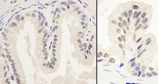 Immunohistochemistry (Formalin/PFA-fixed paraffin-embedded sections) - Anti-PNUTS antibody (AB70247)