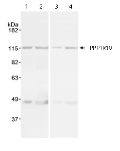 Western blot - Anti-PNUTS antibody (AB70247)