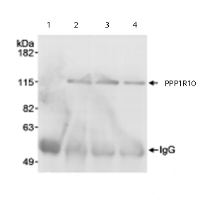 Immunoprecipitation - Anti-PNUTS antibody (AB70248)