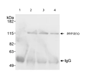 Immunoprecipitation - Anti-PNUTS antibody (AB70248)