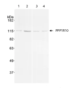 Western blot - Anti-PNUTS antibody (AB70248)