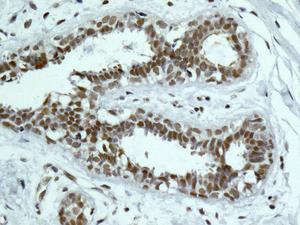 Immunohistochemistry (Formalin/PFA-fixed paraffin-embedded sections) - Anti-PNUTS antibody [EPR11706] (AB173285)