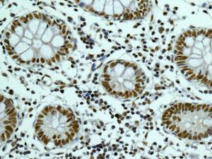 Immunohistochemistry (Formalin/PFA-fixed paraffin-embedded sections) - Anti-PNUTS antibody [EPR11706] (AB173285)