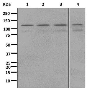 Western blot - Anti-PNUTS antibody [EPR11706] (AB173285)