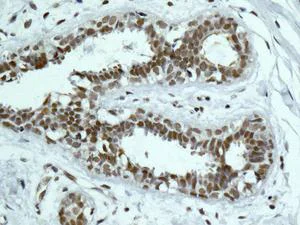 Immunohistochemistry (Formalin/PFA-fixed paraffin-embedded sections) - Anti-PNUTS antibody [EPR11706] - BSA and Azide free (AB249748)