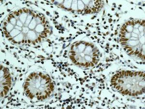 Immunohistochemistry (Formalin/PFA-fixed paraffin-embedded sections) - Anti-PNUTS antibody [EPR11706] - BSA and Azide free (AB249748)