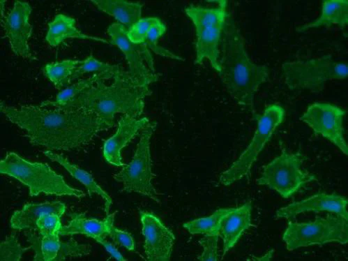 Immunocytochemistry/ Immunofluorescence - Anti-Podoplanin antibody [18H5] - BSA and Azide free (AB10288)