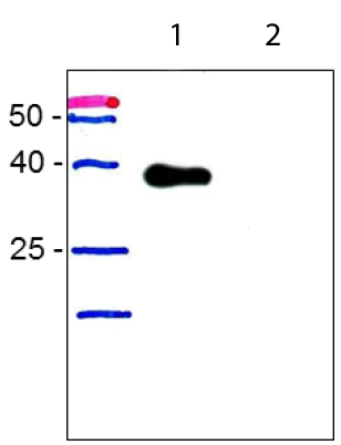 Western blot - Anti-Podoplanin antibody [18H5] - BSA and Azide free (AB10288)