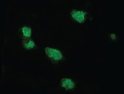 Immunohistochemistry (Frozen sections) - Anti-Podoplanin antibody [8.1.1] (AB92319)