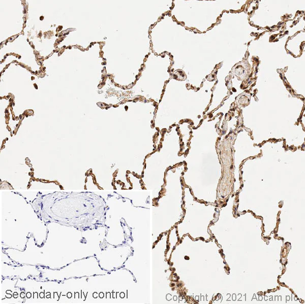 Immunohistochemistry (Formalin/PFA-fixed paraffin-embedded sections) - Anti-Podoplanin antibody (AB109059)
