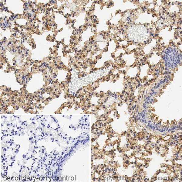 Immunohistochemistry (Formalin/PFA-fixed paraffin-embedded sections) - Anti-Podoplanin antibody (AB109059)