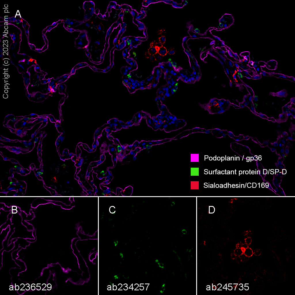 Multiplex immunohistochemistry - Anti-Podoplanin antibody [EPR22182] (AB236529)