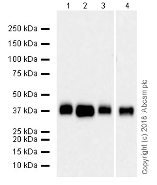 Western blot - Anti-Podoplanin antibody [EPR22182] (AB236529)