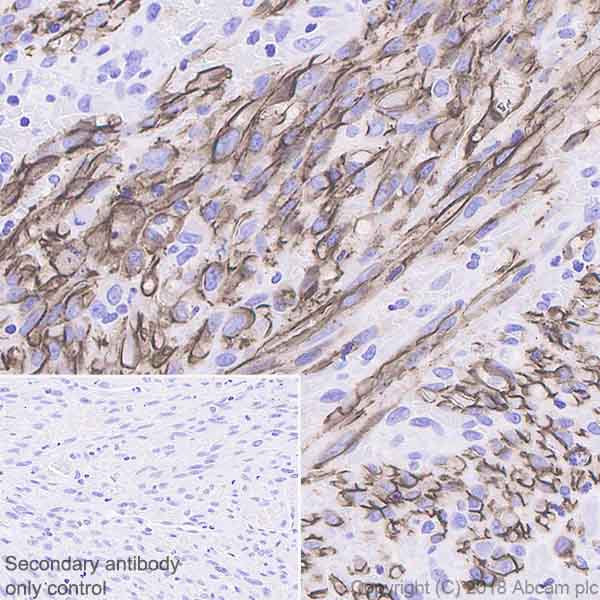 Immunohistochemistry (Formalin/PFA-fixed paraffin-embedded sections) - Anti-Podoplanin antibody [EPR22182] - BSA and Azide free (AB237033)
