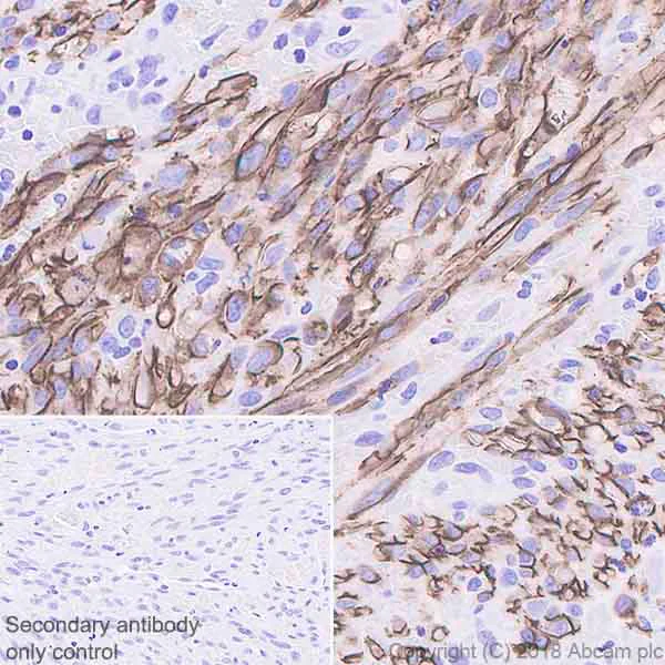 Immunohistochemistry (Formalin/PFA-fixed paraffin-embedded sections) - Anti-Podoplanin antibody [EPR22182] - BSA and Azide free (AB237033)
