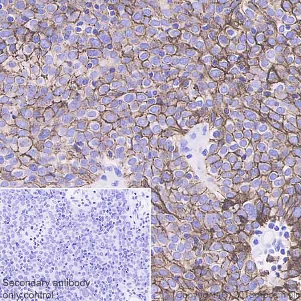Immunohistochemistry (Formalin/PFA-fixed paraffin-embedded sections) - Anti-Podoplanin antibody [EPR22182] - BSA and Azide free (AB237033)