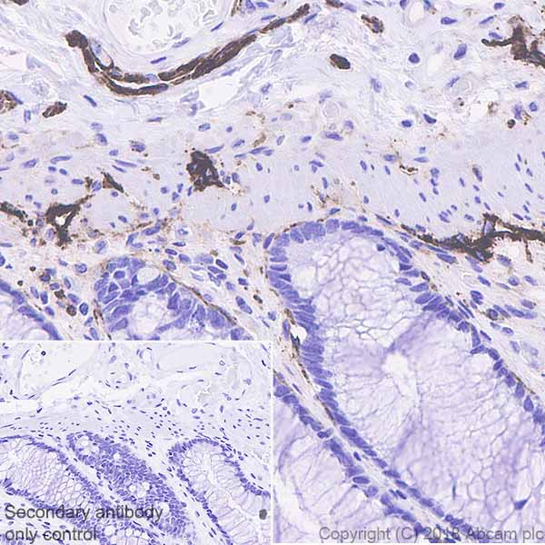 Immunohistochemistry (Formalin/PFA-fixed paraffin-embedded sections) - Anti-Podoplanin antibody [EPR22182] - BSA and Azide free (AB237033)