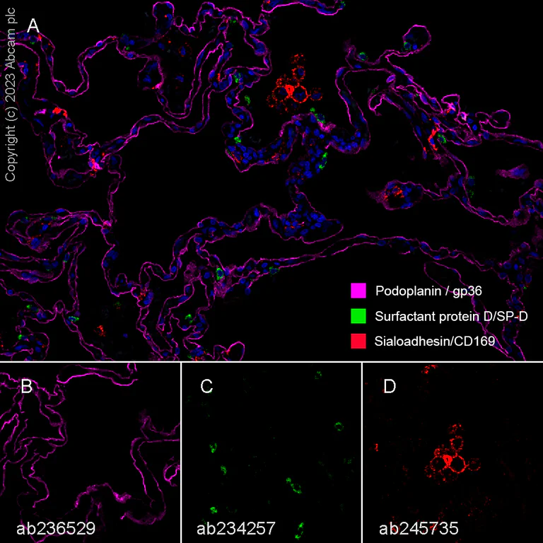 Multiplex immunohistochemistry - Anti-Podoplanin antibody [EPR22182] - BSA and Azide free (AB237033)