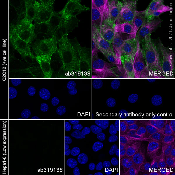 Immunocytochemistry/ Immunofluorescence - Anti-Podoplanin antibody [EPR27193-535] - BSA and Azide free (AB319139)