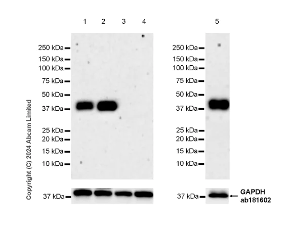 Western blot - Anti-Podoplanin antibody [EPR27193-535] - BSA and Azide free (AB319139)