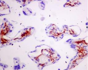 Immunohistochemistry (Formalin/PFA-fixed paraffin-embedded sections) - Anti-Podoplanin antibody [EPR7072] (AB128994), expandable thumbnail