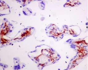 Immunohistochemistry (Formalin/PFA-fixed paraffin-embedded sections) - Anti-Podoplanin antibody [EPR7072] (AB128994)