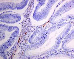 Immunohistochemistry (Formalin/PFA-fixed paraffin-embedded sections) - Anti-Podoplanin antibody [EPR7072] (AB128994), expandable thumbnail