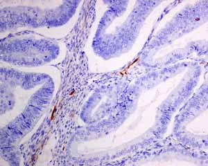 Immunohistochemistry (Formalin/PFA-fixed paraffin-embedded sections) - Anti-Podoplanin antibody [EPR7072] (AB128994)