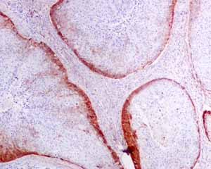 Immunohistochemistry (Formalin/PFA-fixed paraffin-embedded sections) - Anti-Podoplanin antibody [EPR7072] (AB128994), expandable thumbnail