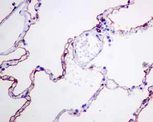 Immunohistochemistry (Formalin/PFA-fixed paraffin-embedded sections) - Anti-Podoplanin antibody [EPR7072] (AB128994)