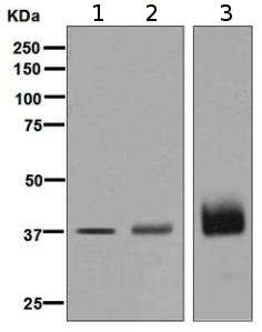 Western blot - Anti-Podoplanin antibody [EPR7072] (AB128994), expandable thumbnail