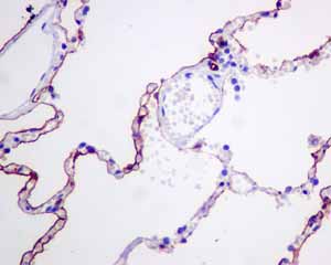 Immunohistochemistry (Formalin/PFA-fixed paraffin-embedded sections) - Anti-Podoplanin antibody [EPR7072] - BSA and Azide free (AB235141)