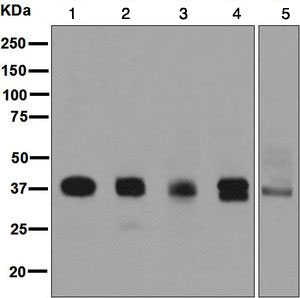 Western blot - Anti-Podoplanin antibody [EPR7073] (AB131216)
