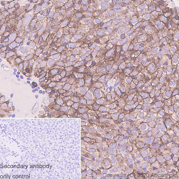Immunohistochemistry (Formalin/PFA-fixed paraffin-embedded sections) - Anti-Podoplanin antibody [LpMab-7] (AB256561), expandable thumbnail