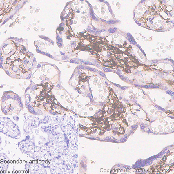 Immunohistochemistry (Formalin/PFA-fixed paraffin-embedded sections) - Anti-Podoplanin antibody [LpMab-7] (AB256561), expandable thumbnail