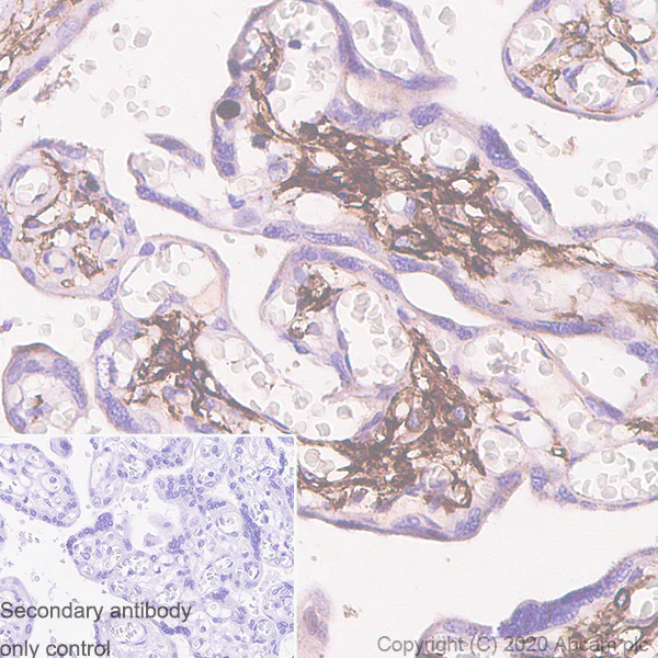 Immunohistochemistry (Formalin/PFA-fixed paraffin-embedded sections) - Anti-Podoplanin antibody [LpMab-7] (AB256561)